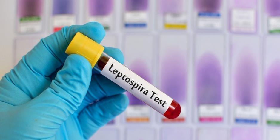 leptospiroza