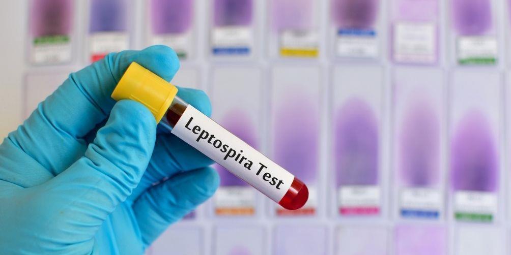 Leptospiroza