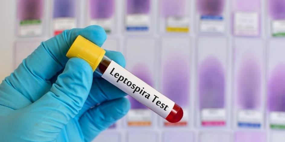Leptospiroza