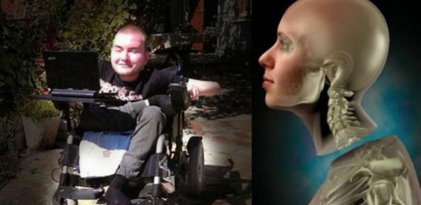 Talijanski neurokirurg odlučan u uspjeh presađivanja glave