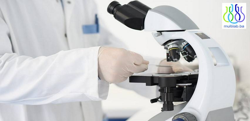 Multi Lab: laboratorijska detekcija Salmonelle