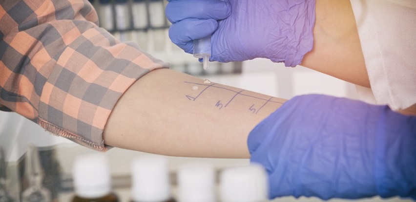 Uradite testiranje na alergije kako bi bili sigurni na šta ste tačno alergični