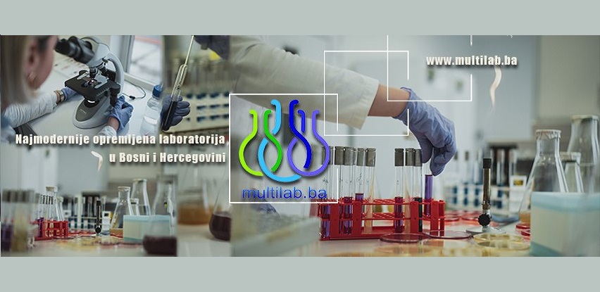 MULTI LAB – najmodernije opremljena laboratorija u BiH